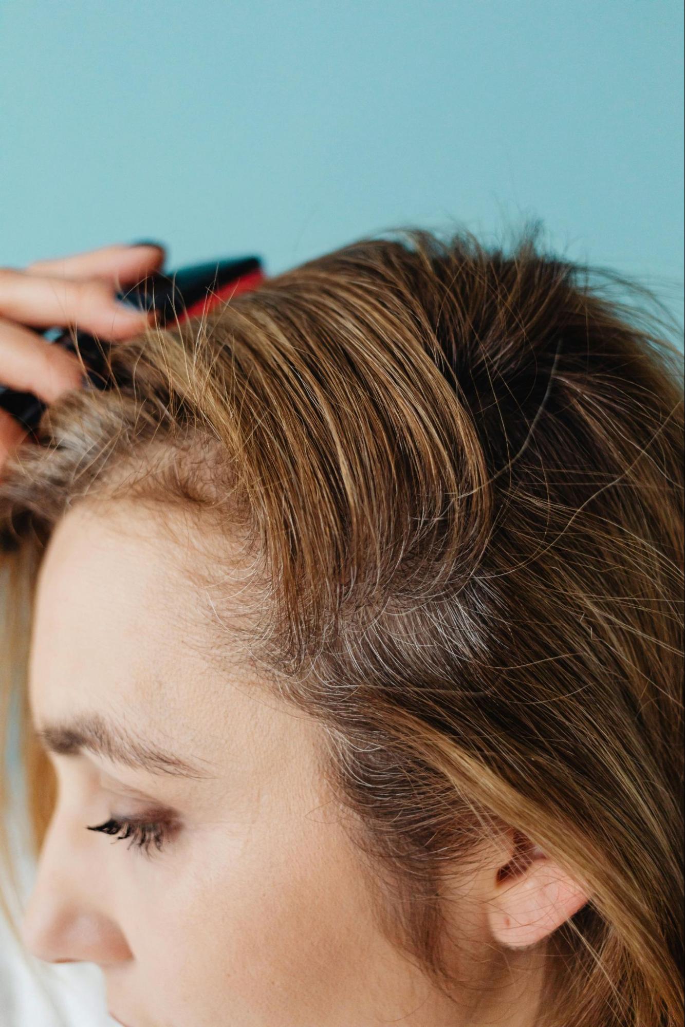 How to Keep Your Scalp Healthy (Including Tips for Curly Hair)